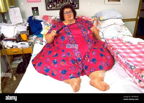 killeen texas usa 1993 morbidly obese woman weighing 600 lbs confined to bed due to her