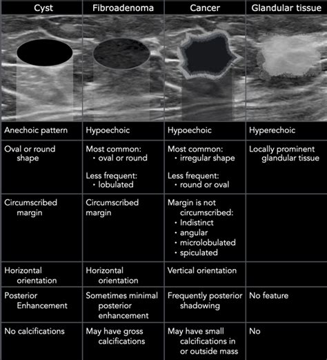 Ultrasound Of Pediatric Breast Masses What To Do With