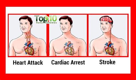 Understanding Heart Attack Cardiac Arrest And Stroke Top 10 Home
