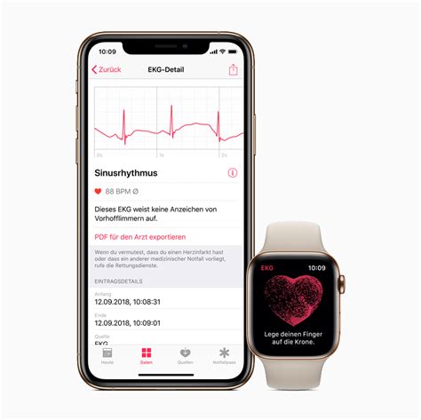 Venta App Electrocardiograma Apple Watch En Stock