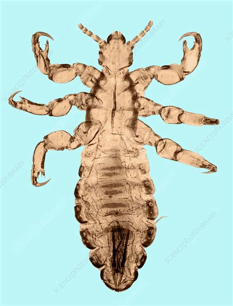 Head Louse Lm Stock Image C Science Photo Library