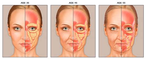 Dermasphere Anatomy Of An Aging Face