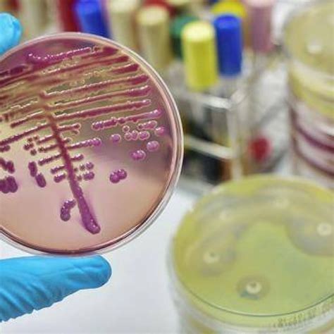 La Oms Publicó Una Lista De Bacterias Resistentes A Los Antibióticos