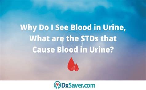 Types Of Stds With Blood In Urine Causes Treatment And Testing Cost