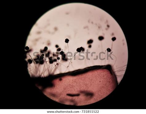 Mold Rhizopus Fungus Grown Agar Stock Photo 731851522 Shutterstock