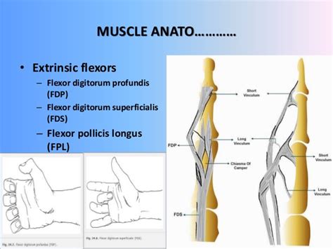 Fpl tendon repair hand rehab belfast regimen. Acute hand injury management