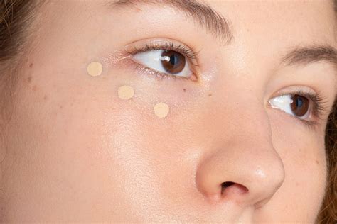 The 12 Best Concealers For Acne To Cover Every Type Of Blemish