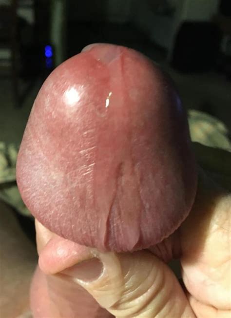 Huge Mushroom Head Cocks 85 Pics XHamster