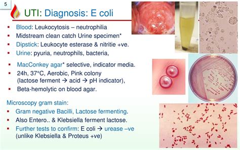 Ppt Pathology Of Urinary Tract Infectionws Powerpoint Presentation