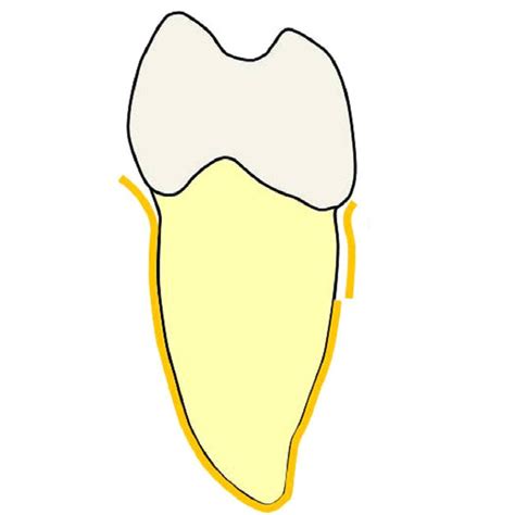 Cemental tears often show characteristics mimicking a periapical or periodontal lesion. Periodontitis affecting teeth supportive tissues ...