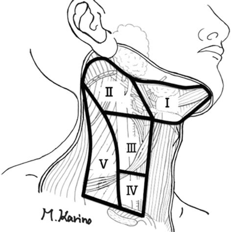 Illustration Of Each Level Of The Cervical Lymph Node Download