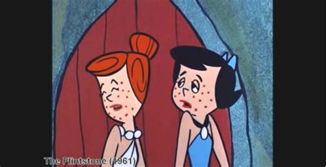 Measles On 60s Sitcoms And Cartoons In The Days Before