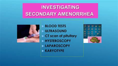Secondary Amenorrhea Investigation And Diagnosis Youtube