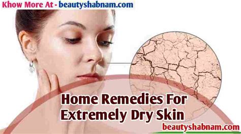 Home Remedies For Extremely Dry Skin 5 Best Home Remedies For Dry