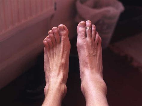 What Doctors Can Tell About Your Health Just By Looking At Your Feet