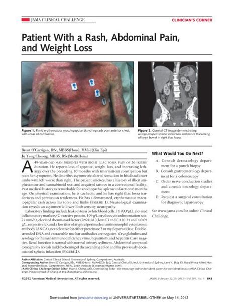 Patient With A Rash Abdominal Pain And Weight Loss