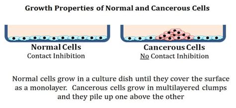 Characteristics Of Cancer Cells Easybiologyclass