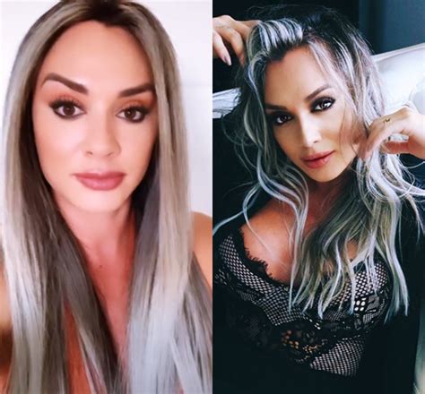 Depois passou para blog do holanda e por último portal do holanda. Juju Salimeni faz harmonização facial; confira o resultado