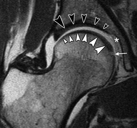 New Developments In Hip Imaging Radiology