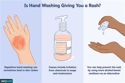 Hand Rashes Due To Handwashing