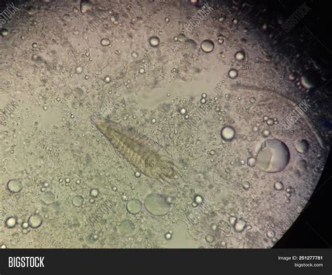 Demodex Parasite Under Image And Photo Free Trial Bigstock