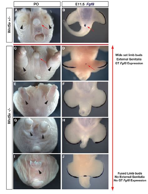 Variably Penetrant Development Of External Genitalia In Wnt5a Mice