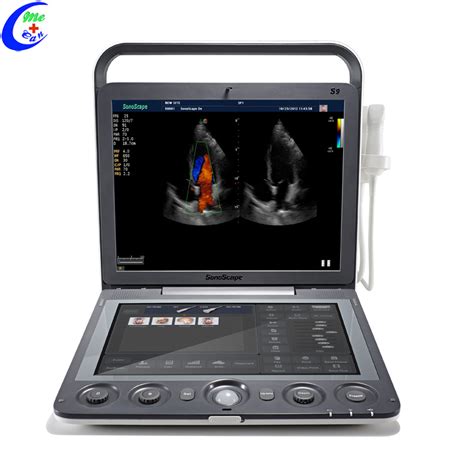 Sonoscape S9 Medical Echography Portable Ultrasound Machine 3d 4d