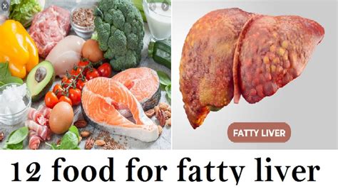 12 Foods To Help Fatty Liver Disease Reversal 6 Foods To Avoid If
