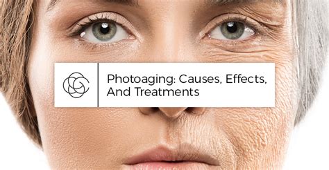 Photoaging Causes Effects And Treatments Cosmedical Technologies