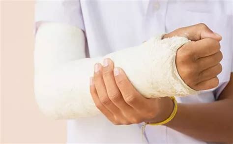 Care Of Casts And Splints