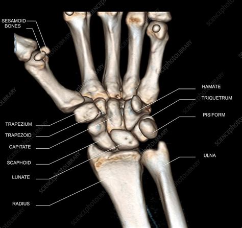 Normal Wrist 3d Ct Scan Stock Image C0468610 Science Photo Library