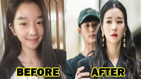 Seo Ye Jis Plastic Surgery Is Making Rounds On The Internet