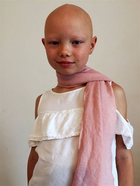 Girl With Alopecia Becomes Model ‘never Lost Her Confidence