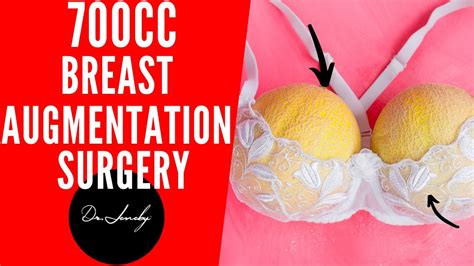 700cc Breast Augmentation 162 Lbs San Antonio Austin Breast Implant