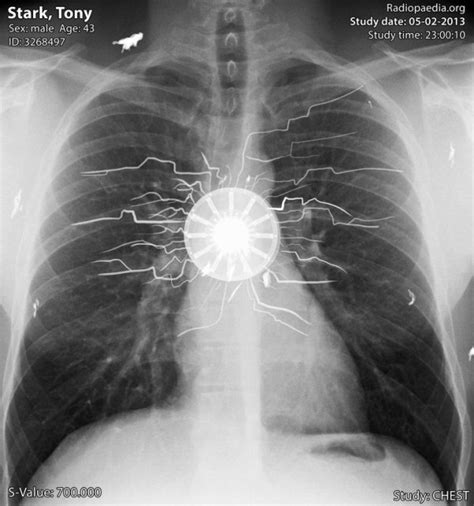 Interesting X Rays And Scans Others