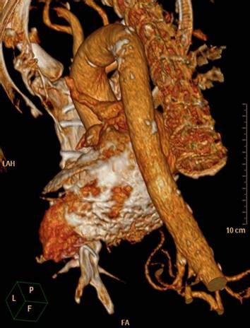 Guten abend hazel, die myokarditis ist eine sammelbezeichnung für entzündliche erkrankungen des. Kardiologie - Röntgen-Thorax, Thorax-CT, Kardio-CT, Kardio-MR