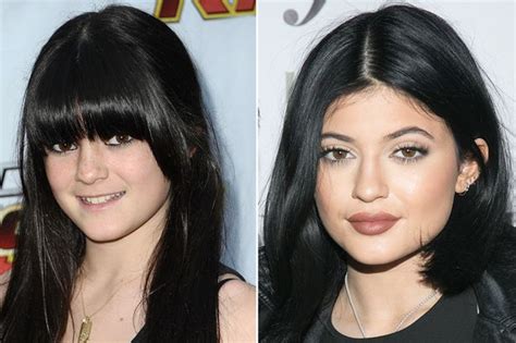 Kylie Jenner Denies Having Lip Implants But Admits She Thinks A Big