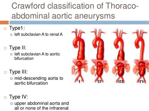 Aortic Aneurysm Imaging
