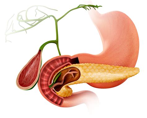 People with pancreatic cancer may experience the following symptoms or signs. What Can Cause Pale Stool or Clay-Colored Stool?