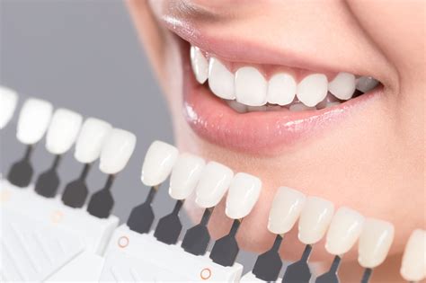 How Do Porcelain Veneers Improve Your Smile