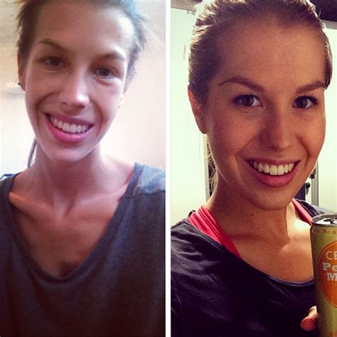 A Girls Journey From Anorexia To Fitness On Instagram Q8 All In One