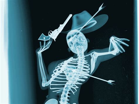 X Ray Skeleton Art