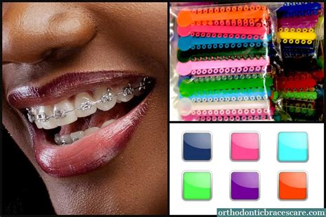 Best Braces Colors For Light Skin Makeovermania Amybaybeezz