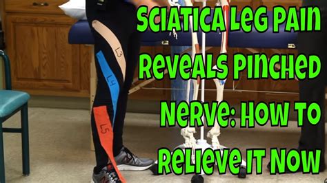 Sciatica rears its ugly head when something compresses the nerve. Sciatica Leg Pain Reveals Pinched Nerve: How to Relieve It ...