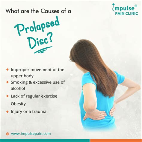 What Are The Causes Of A Prolapsed Disc Impulse Pain Clinic