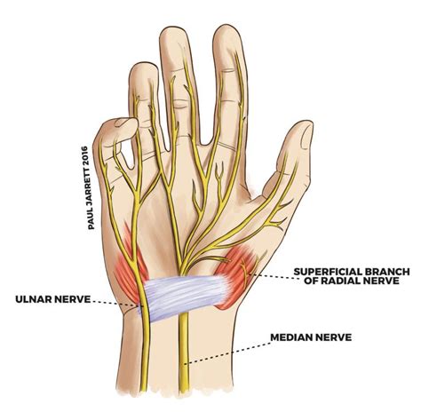 The Wrist And Hand Are Labeled In This Diagram Which Shows The