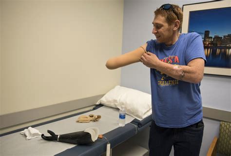 Vancouver Man On Road To Recovery After Getting New Arm The Columbian