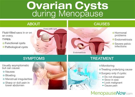 What Causes Ovarian Cysts After Menopause Coach M Morris