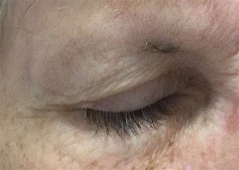 Phibrows Microblading For Brow Hair Loss Naples Fl