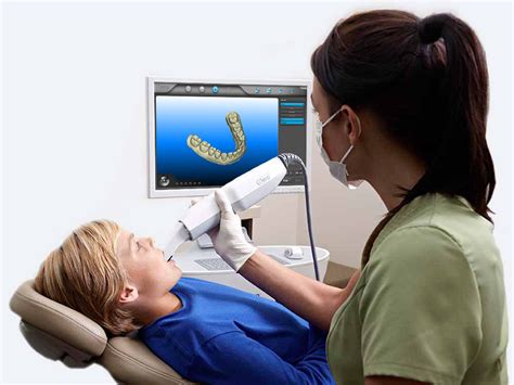 The Itero Digital Scan Your First Step To A Customized Smile Masri